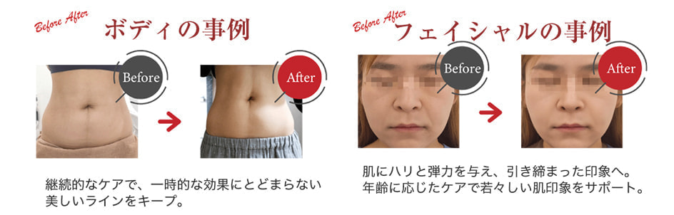 サーモライン使用事例